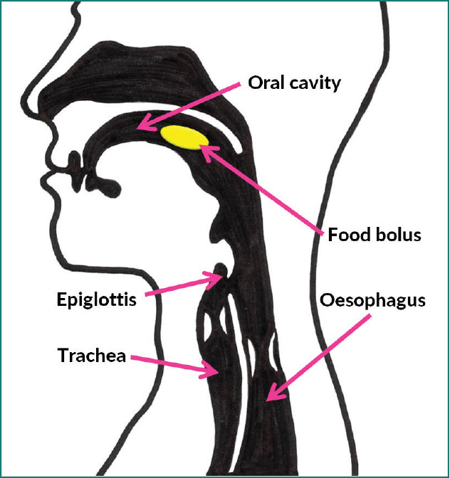 Identifying the signs and symptoms of dysphagia
