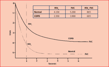 Figure 3. Dynamic lung volumes