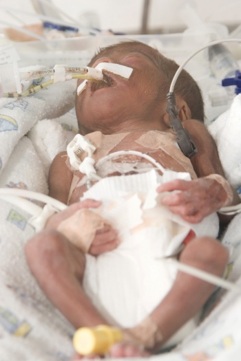 Low-tech developments, like our understanding of  hypothermia have also been critical