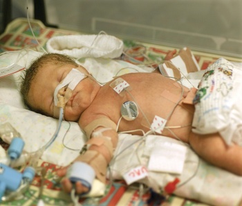 Much of the ICU ‘help’ (eg. ventilator support) is associated with problems that can affect long-term quality of life, such as chronic lung disease and oxygen dependency