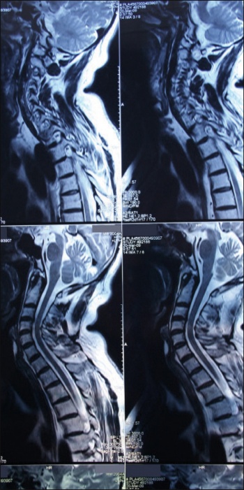 MRI is the most effective way of showing whether a patient’s back pain is amenable to minimally invasive surgery, according to neurosurgeon Mr Steven Young