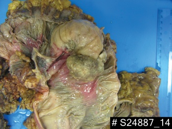 Figure 3. Pathology specimen