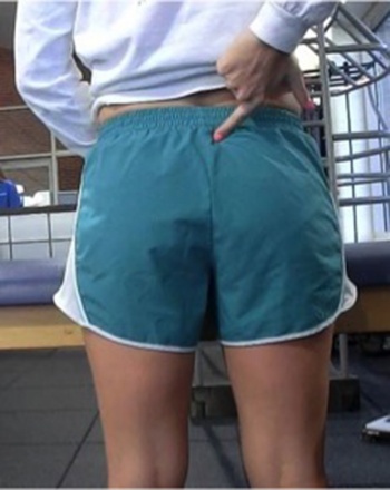 Figure 1. Fortin’s finger test