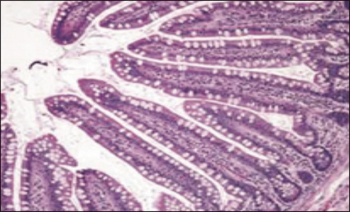 Figure 1. Small-bowel histopathologic findings in coeliac disease (from Mayo Clinic Gastroenterology and Hepatology Board Review 5th edition) (4)                            A - Normal findings (haematoxylin-eosin)