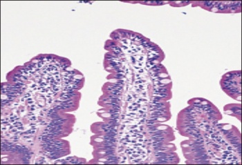 B - Intraepithelial lymphocytes alone as seen in an early March lesion of coeliac disease (haematoxyln-eosin)
