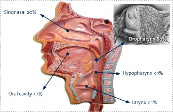 Figure 1. Anatomical distribution of HPV-related head and neck cancer (acknowledgement Prof Westra)