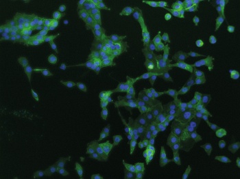 PD-L1 expression in EGFR mutation positive H1975 cells 