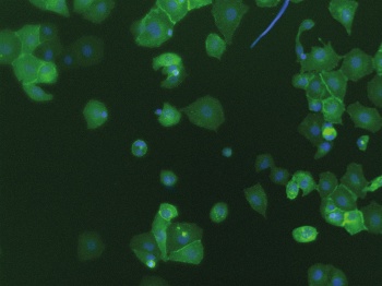 PD-L1 expression in TKI resistant H1975 cells  